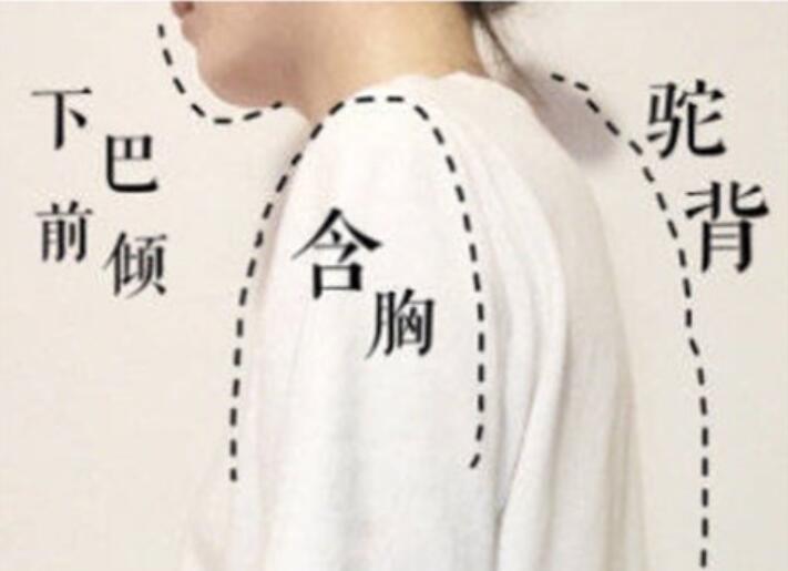 南寧美容學(xué)校：堅(jiān)持一個月，駝背變直背