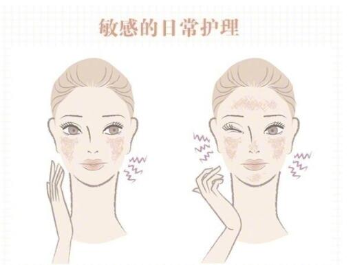 敏感肌保養(yǎng)大全！