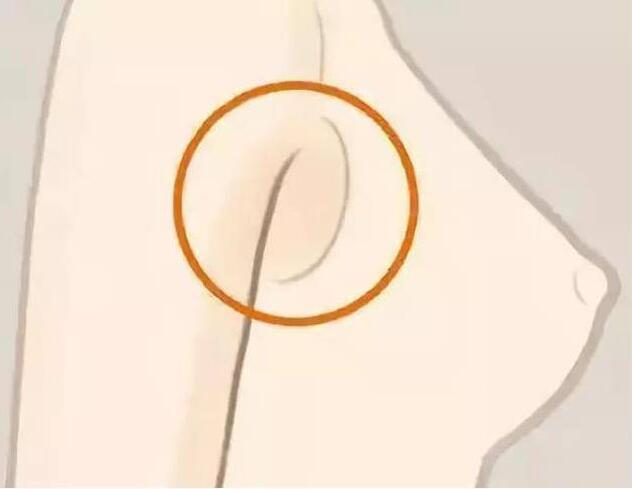 減副乳，瘦手臂一招就解決！