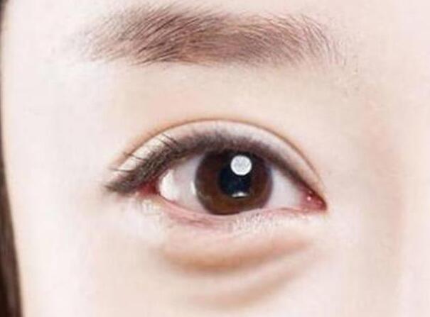 眼袋？淚溝？臥蠶？南寧美容學(xué)校教你辨別