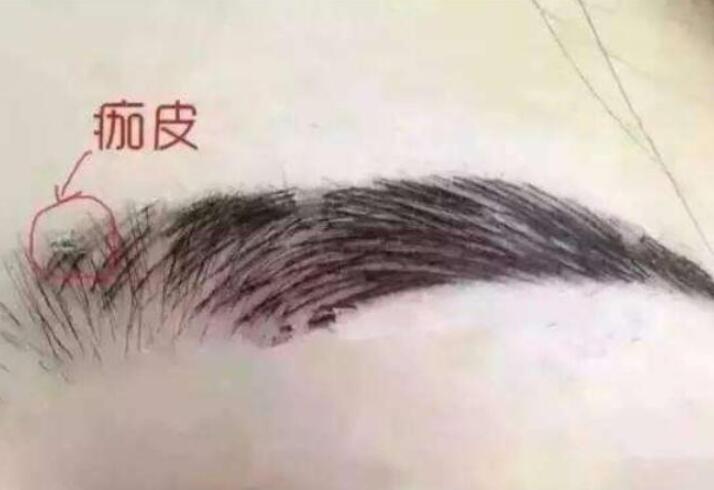紋眉結(jié)痂時要注意什么？麗紋竹繡學(xué)校教你