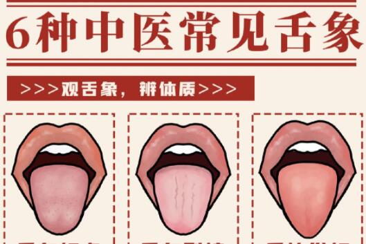 6種常見中醫(yī)舌診判定，快和廣西中醫(yī)美容一起學