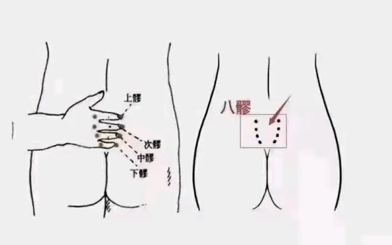 疏通八髎注意事項(xiàng)，南寧中醫(yī)美容學(xué)校培訓(xùn)內(nèi)容