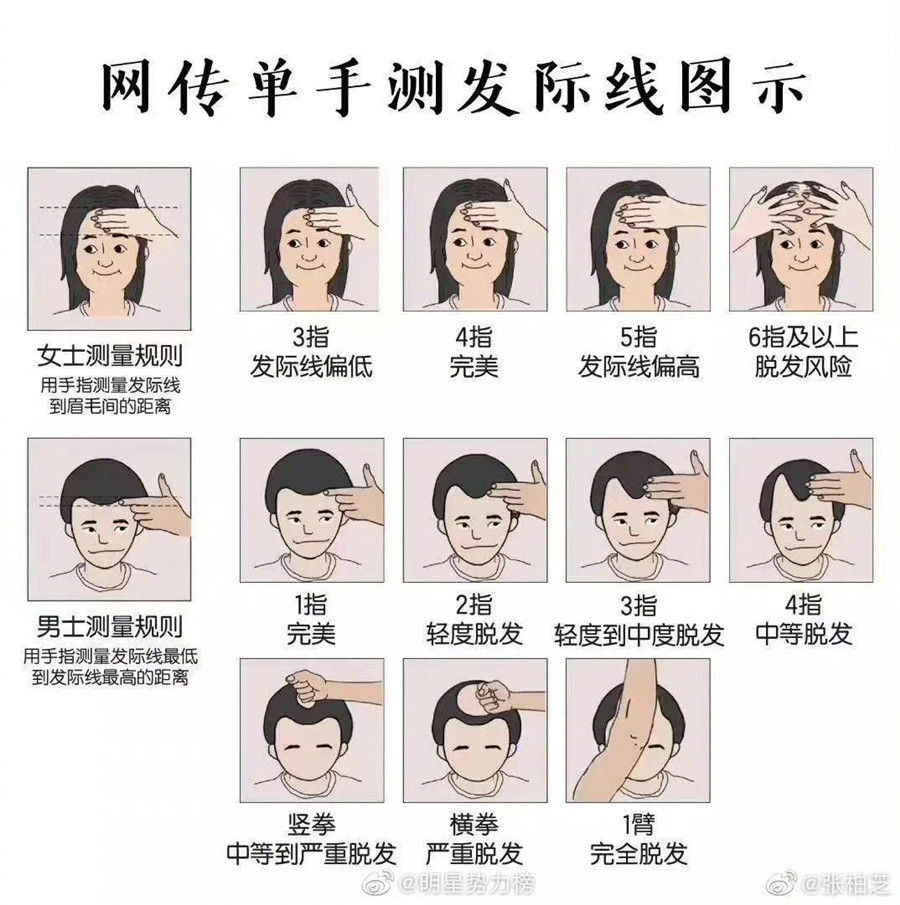 廣西頭療養(yǎng)發(fā)培訓(xùn)：單手測(cè)發(fā)際線教程