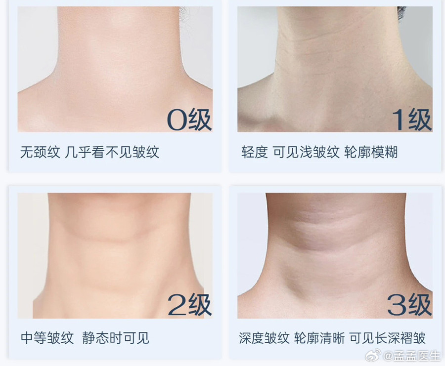 如何緩解頸紋？南寧美體美容管理培訓(xùn)