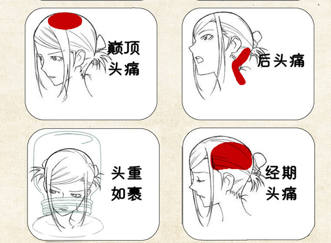 不同頭痛類型經(jīng)絡(luò)護理方法，廣西中醫(yī)美容培訓(xùn)